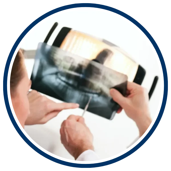 bone-graft