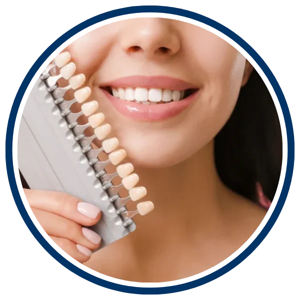 dental-veneers
