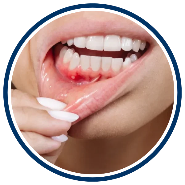 periodontal-treatment
