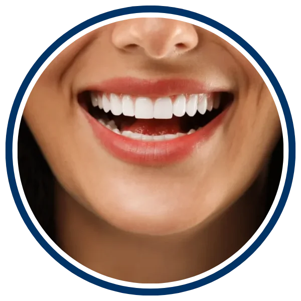 smile-makeovers